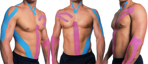 Resultado de imagem para kinesio tape